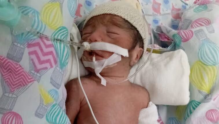 Confusión en Santa Cruz: Declararon muerto a un bebé, la abuela fue a retirar el cuerpo y estaba vivo 3 santa cruz - 2