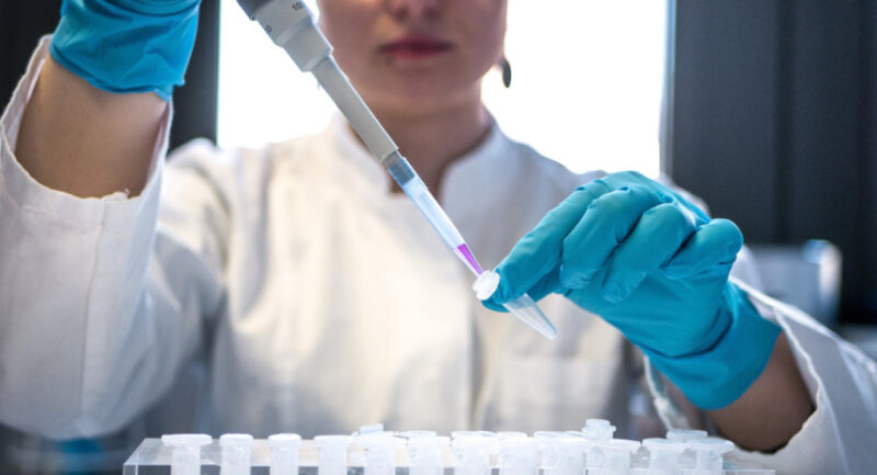 Test de sangre experimental detectaría el Alzheimer con más del 90% de precisión Alzheimer - 4
