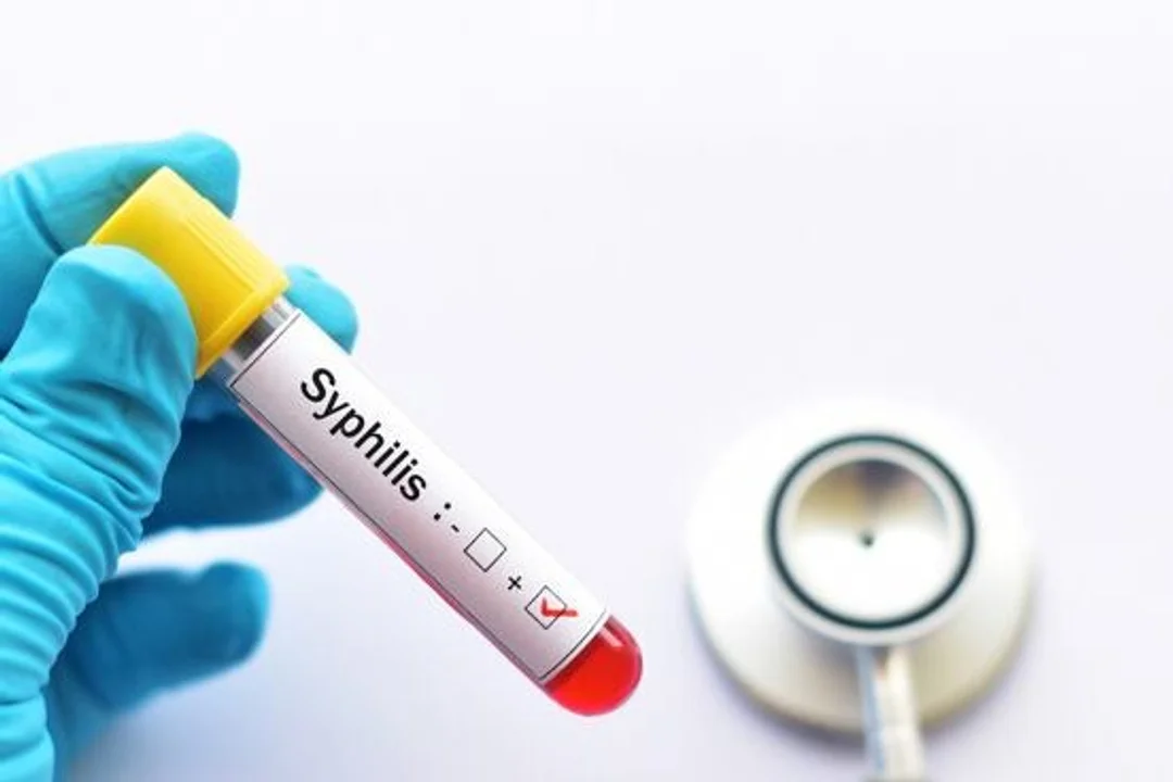 Preocupa el avance de la sífilis: se triplicaron los casos en adolescentes y recién nacidos en todo el país 2 sifilis - 1
