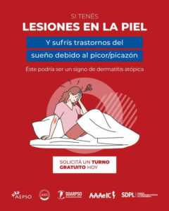 Campaña gratuita de detección de dermatitis atópica en Misiones: atención en Posadas y Oberá 2 dermatitis