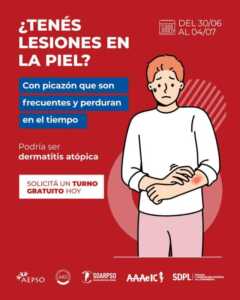Campaña gratuita de detección de dermatitis atópica en Misiones: atención en Posadas y Oberá 3 dermatitis