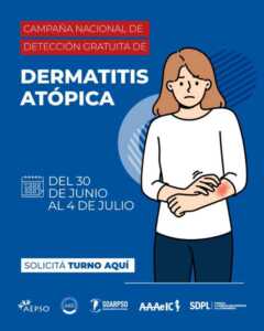 Campaña gratuita de detección de dermatitis atópica en Misiones: atención en Posadas y Oberá 4 dermatitis