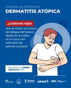 Campaña gratuita de detección de dermatitis atópica en Misiones: atención en Posadas y Oberá 5 dermatitis
