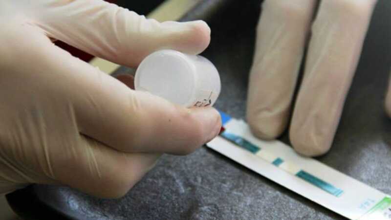 Este viernes habrá testeos rápidos, gratuitos y confidenciales para VIH en Posadas 2 Los operativos estarán disponibles de 8 a 12 horas, y no se requiere turno previo ni orden médica. La prueba es rápida, segura y totalmente confidencial