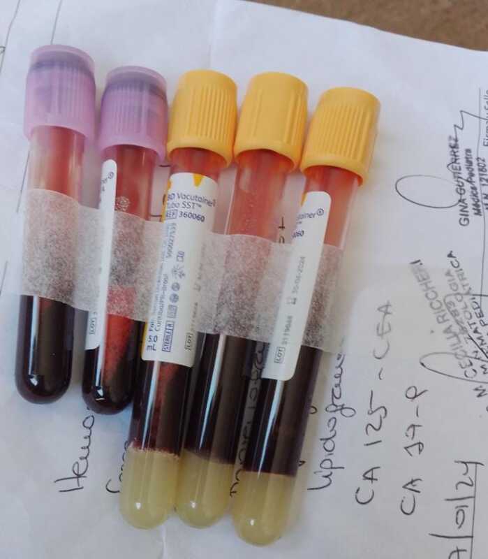 Familia misionera clama por ayuda para costear tratamiento de su hija con enfermedad rara 3 Familia