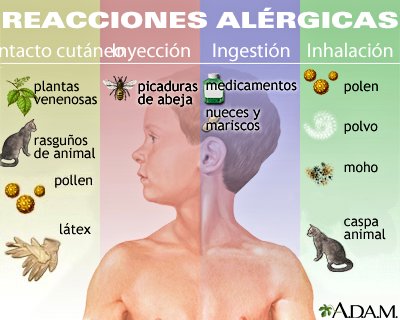 Alergias en aumento: causa y cómo detectarlas 5 GvVles1XYAA65M4 - 4