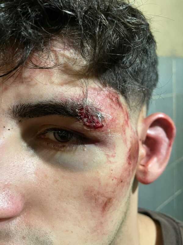 Brutal golpiza en un boliche de Posadas: “Me arrastraron a un lugar sin cámaras y pensé que me mataban” 1 posadas