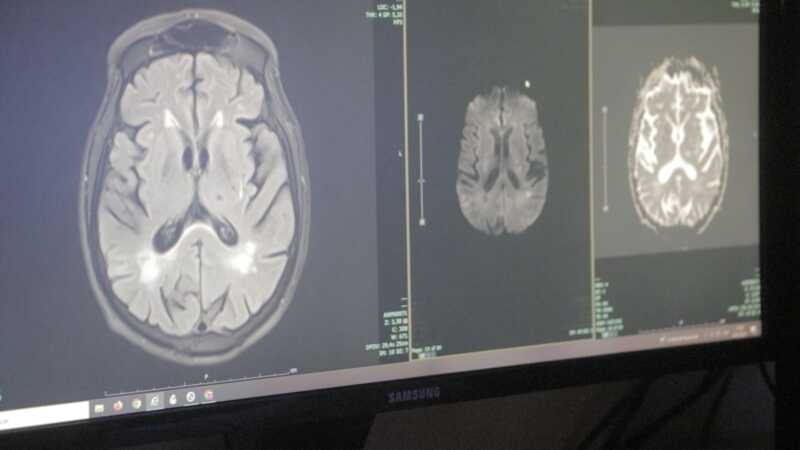 El Madariaga se posiciona con cirugía de epilepsia de alta complejidad única en la región 6 "En lo que respecta a urgencias neurológicas como el ACV, colaboramos de manera constante con la Guardia del hospital, evaluando cada caso y determinando la conducta terapéutica a seguir", explicó Hardaman.