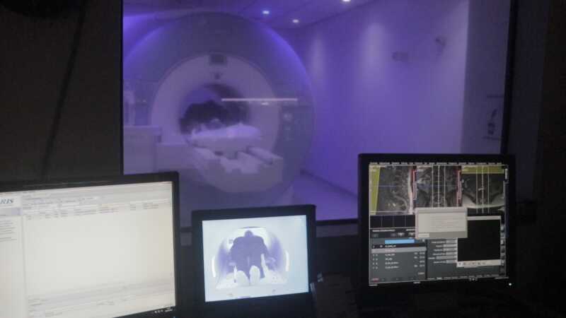 El Madariaga se posiciona con cirugía de epilepsia de alta complejidad única en la región 5 El Servicio de Neurología del Madariaga está conformado por cinco profesionales que atienden unas 400 consultas mensuales, tanto en modalidad presencial como a través de la plataforma Alegramed, que permite prescripción electrónica y seguimiento remoto.