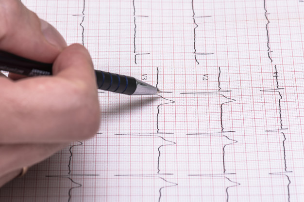 Muerte súbita en adolescentes: la advertencia de la FAC sobre controles y prevención 4 electrocardiograma - 3