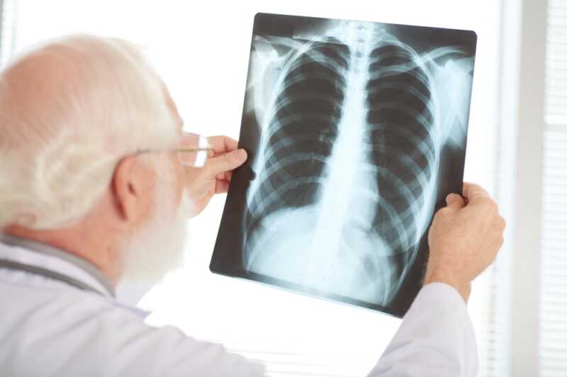 Ordenan internación compulsiva de 4 adultos con tuberculosis que contagiaron a menores en Misiones 5 tuberculosis - 4