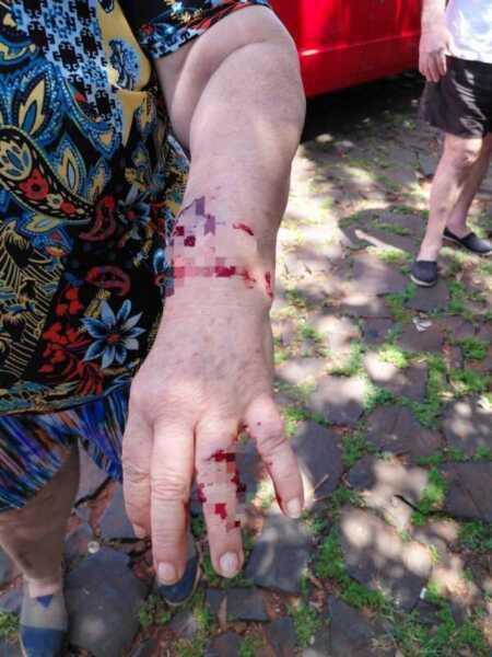 Dos mujeres resultaron heridas tras ser atacadas por perros pitbull en Posadas pitbull posadas