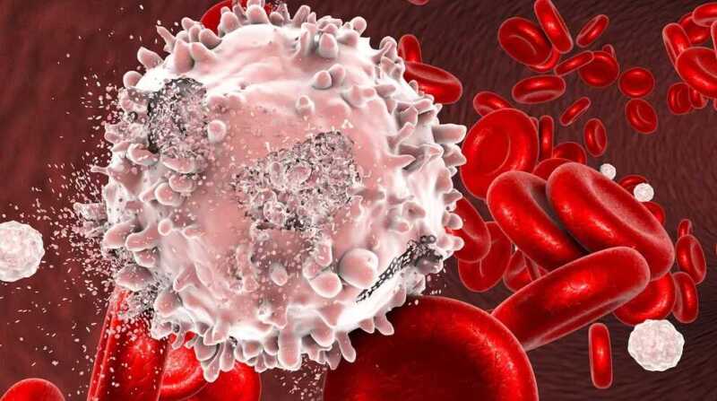 Leucemia mieloide crónica: “Todos los pacientes acceden al tratamiento sin costo“ 6 leucemia mieloide cronica - 5