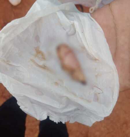 Brutal ataque en Posadas: una menor le cortó parte de la oreja a una mujer con un cuchillo Imagen de WhatsApp 2025 11 03 a las 19.49.11 0aad4455 e1762216043832 - 3