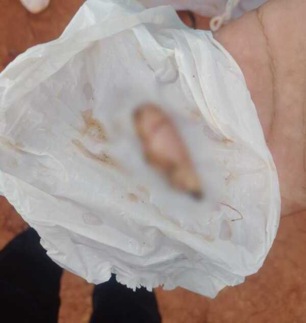 Brutal ataque en Posadas: una menor le cortó parte de la oreja a una mujer con un cuchillo Imagen de WhatsApp 2025 11 03 a las 19.49.11 0aad4455 e1762216043832 - 2