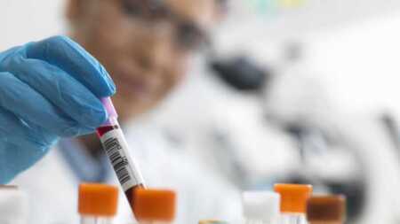 Una técnica basada en CRISPR demuestra capacidad para erradicar el VIH latente VIH
