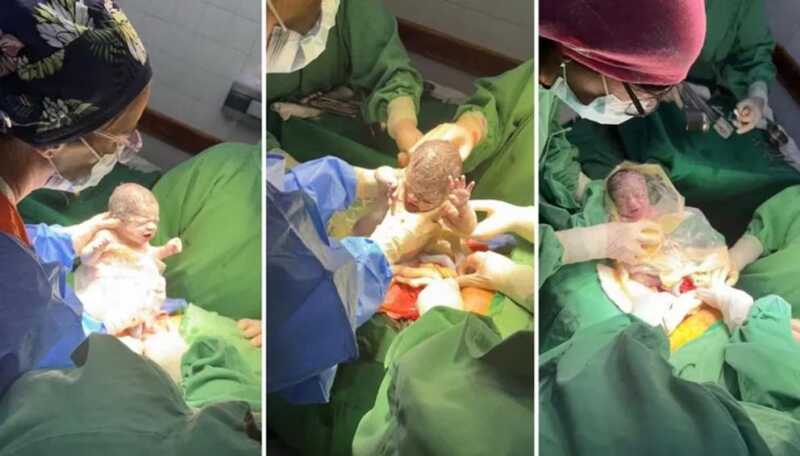 Sorpresa en Chubut: nacieron “trigemelas”, un fenómeno casi imposible 3 WhatsApp Image 2025 12 29 at 10.07.04 1 - 2