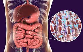 SIBO: por qué “aparecen más casos”, cómo se diagnostica y el riesgo de las dietas sin control médico 6 sibo2 - 5
