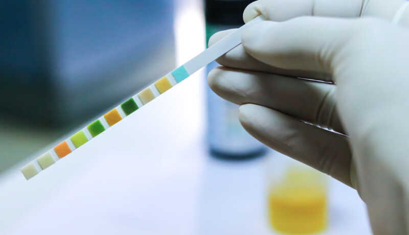 Un análisis de orina de rutina podría cambiar el futuro de la salud renal en Argentina 1 La orina puede revelar señales tempranas de enfermedad renal y cardiovascular.