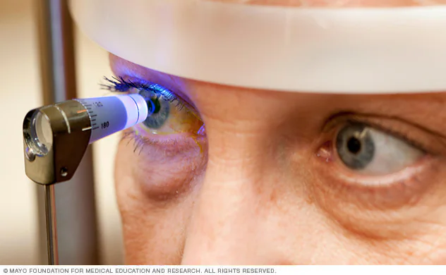 Glaucoma: la enfermedad silenciosa que ya afecta a más de un millón de argentinos 1 Glaucoma