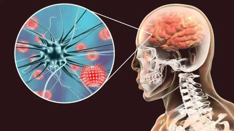 Aumentan los casos de meningitis en Argentina y alertan por la baja en la vacunación 6 HII6i5mXgAAPlEG - 5