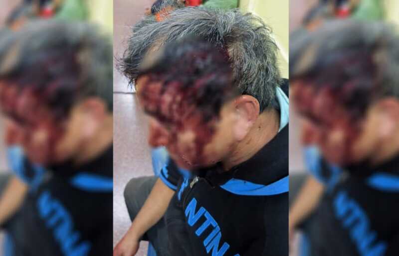 Violenta pelea entre vecinos en Posadas, dejó un hombre hospitalizado pelea