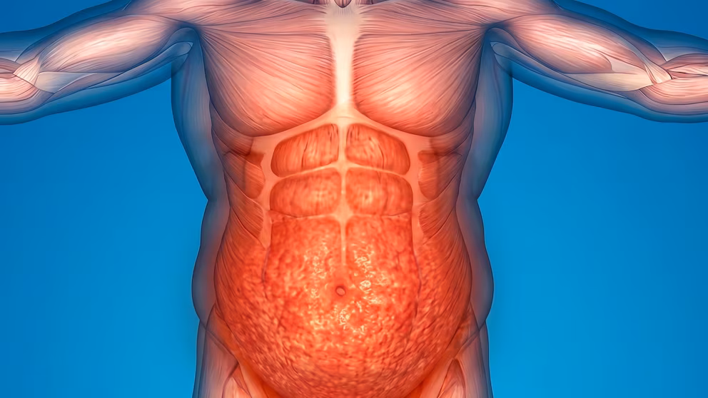 Apnea del sueño: una terapia para la obesidad muestra resultados alentadores 8 ERMVWWE4QVD2FOJAEobesidad3WAPUG3SZA - 7