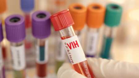 VIH en Argentina: casi el 50% de los diagnósticos se detectan en etapas avanzadas VIH