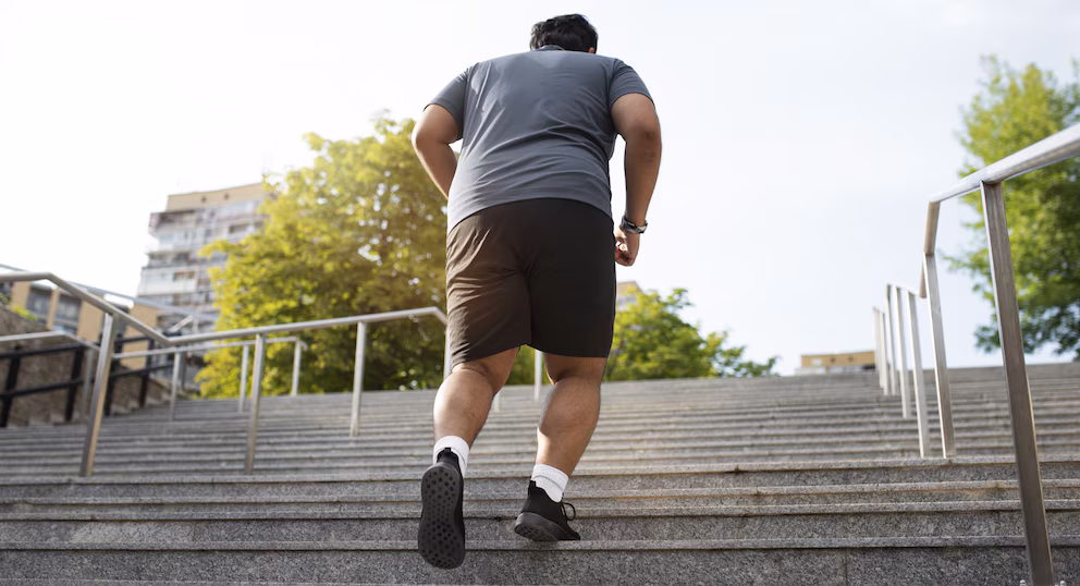Apnea del sueño: una terapia para la obesidad muestra resultados alentadores 6 obesidad2 - 5