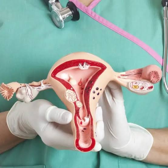 Misiones incorpora un ensayo clínico internacional para pacientes con cáncer de cuello uterino 2 Misiones cáncer