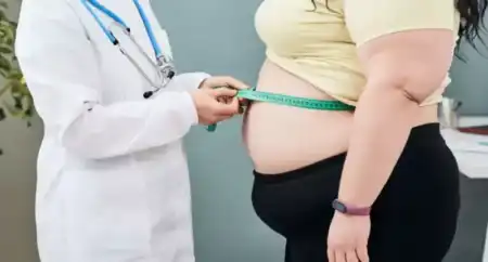 Obesidad